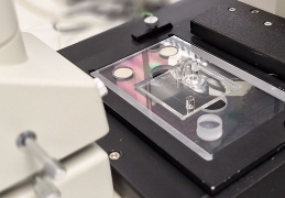 microfluidic electrophoresis